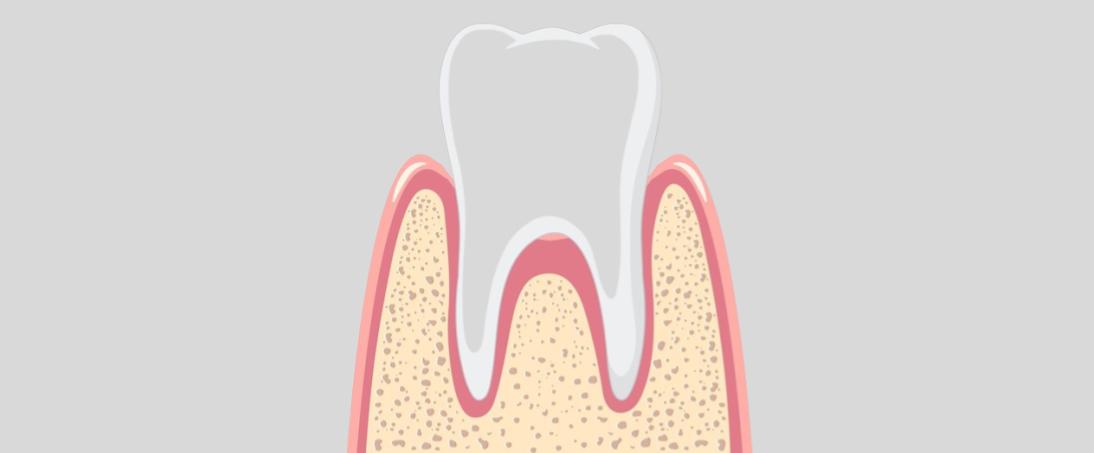Oral biofilms and recombinant dextranase
