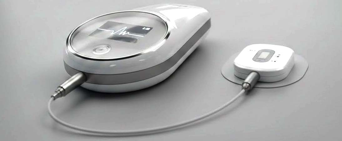 Artificial pancreas device system: A technological progress towards a cure