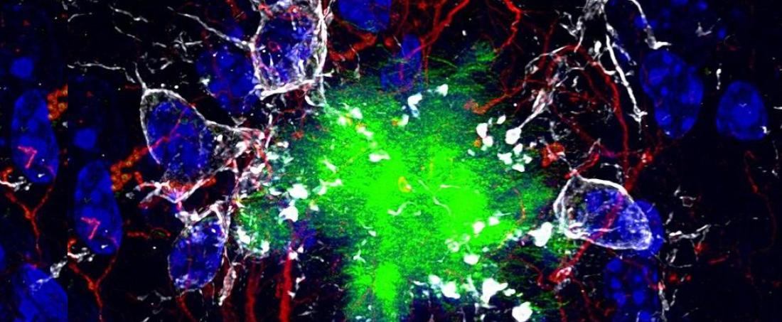 In silico approach for developing potential therapeutic drug molecules against Alzheimer’s disease.